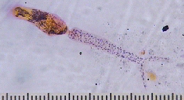 Cercaire de Schistosome mansoni