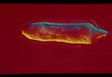 Miracidium de Schistosoma mansoni