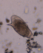 Oeuf de Schistosoma mansoni