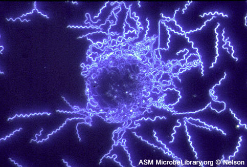 Borrelia